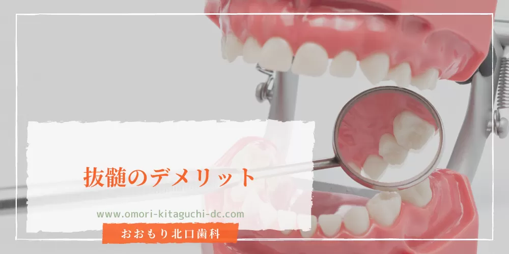 抜髄のデメリット