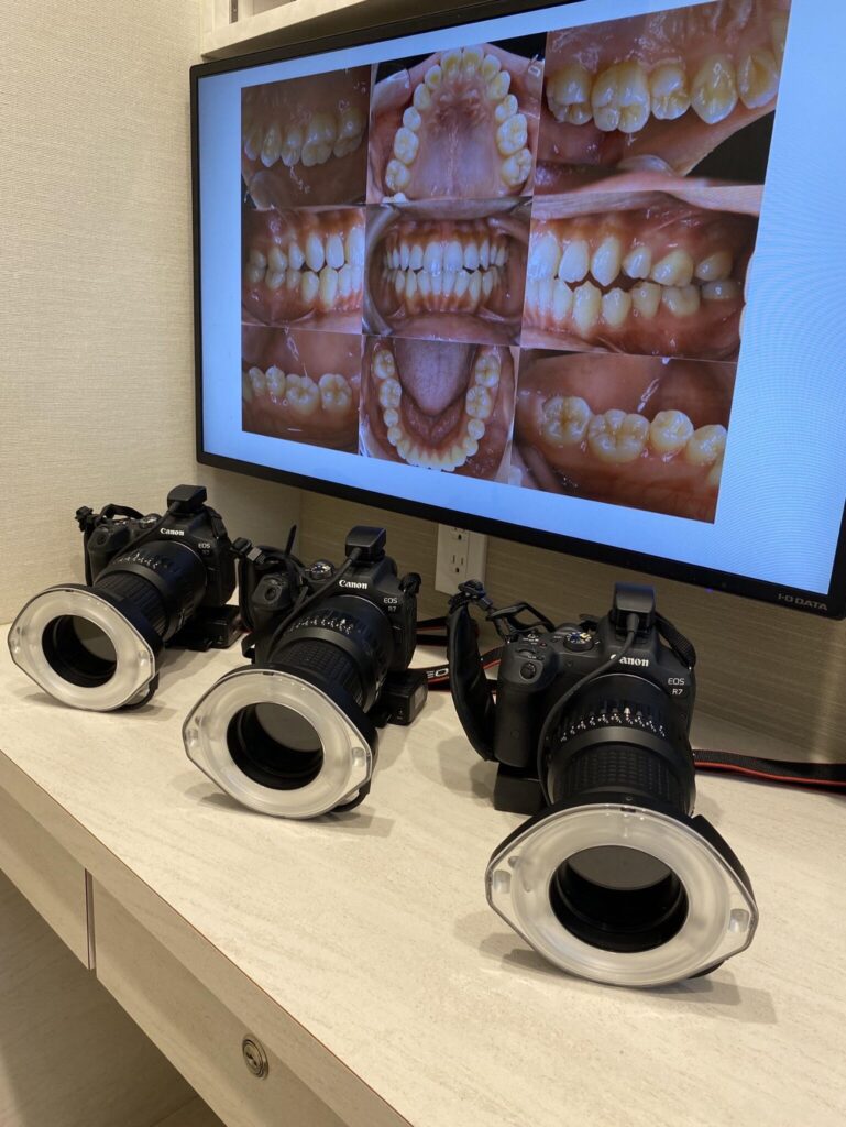 歯科医院の設備に関して④【口腔内規格写真】 | おおもり北口歯科