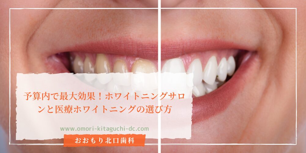 予算内で最大効果！ホワイトニングサロンと医療ホワイトニングの選び方