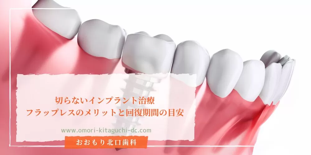 切らないインプラント治療｜フラップレスのメリットと回復期間の目安