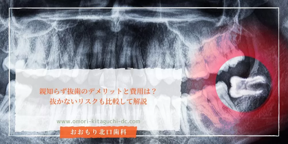 親知らず抜歯のデメリットと費用は?抜かないリスクも比較して解説