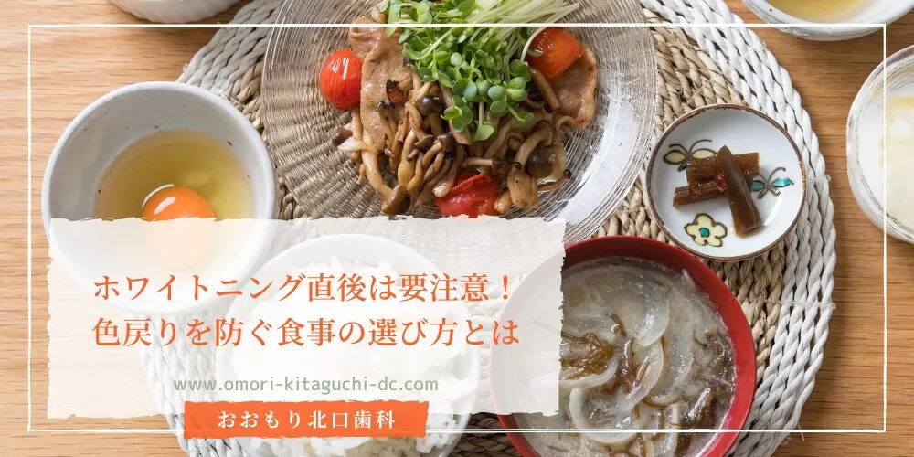 ホワイトニング直後は要注意！色戻りを防ぐ食事の選び方とは