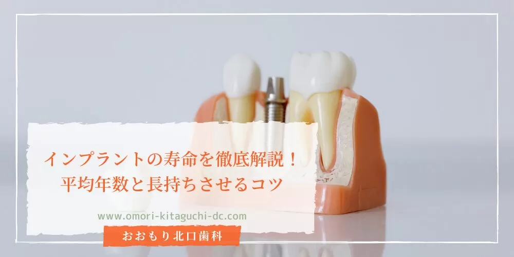 インプラントの寿命を徹底解説！平均年数と長持ちさせるコツ