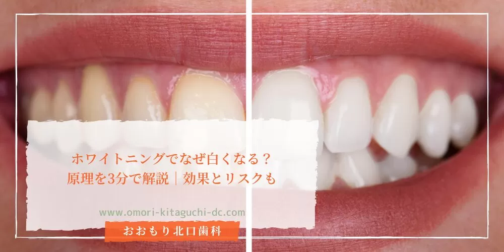 ホワイトニングでなぜ白くなる？原理を3分で解説｜効果とリスクも