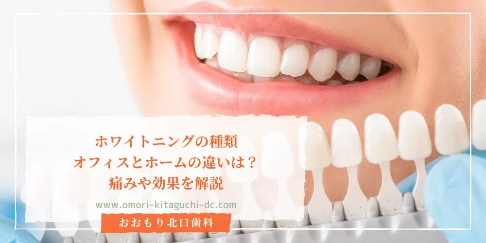 ホワイトニングの種類｜オフィスとホームの違いは？痛みや効果を解説