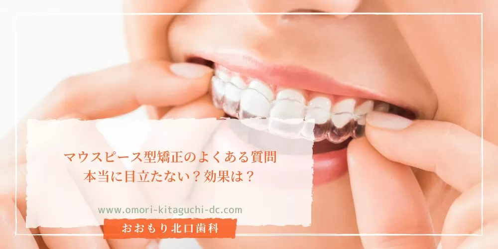 マウスピース型矯正のよくある質問｜本当に目立たない？効果は？