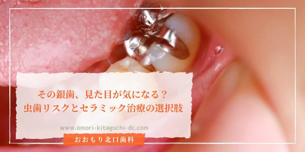 その銀歯、見た目が気になる？虫歯リスクとセラミック治療の選択肢