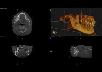 大森駅北口徒歩50秒の歯医者･歯科「おおもり北口歯科」｜充実した設備で行う3D精密検査・診断【歯科用CT】